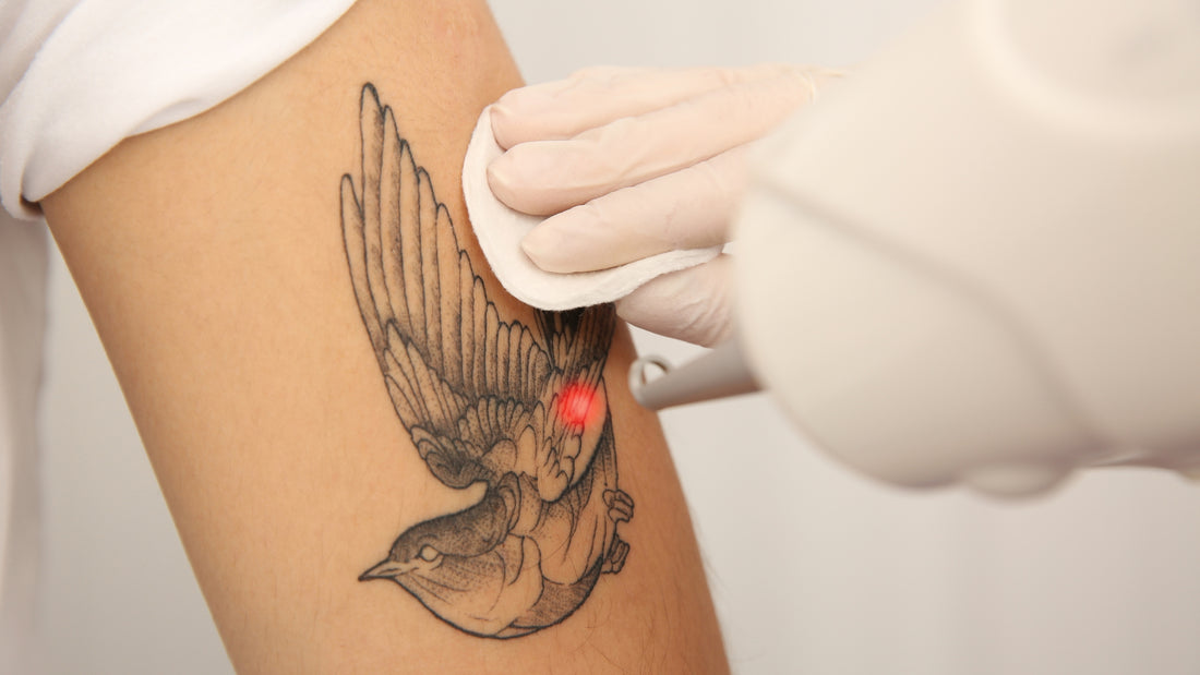 How Painful Is Tattoo Removal? Insights and Tips for South Africans from Deluxe Shop