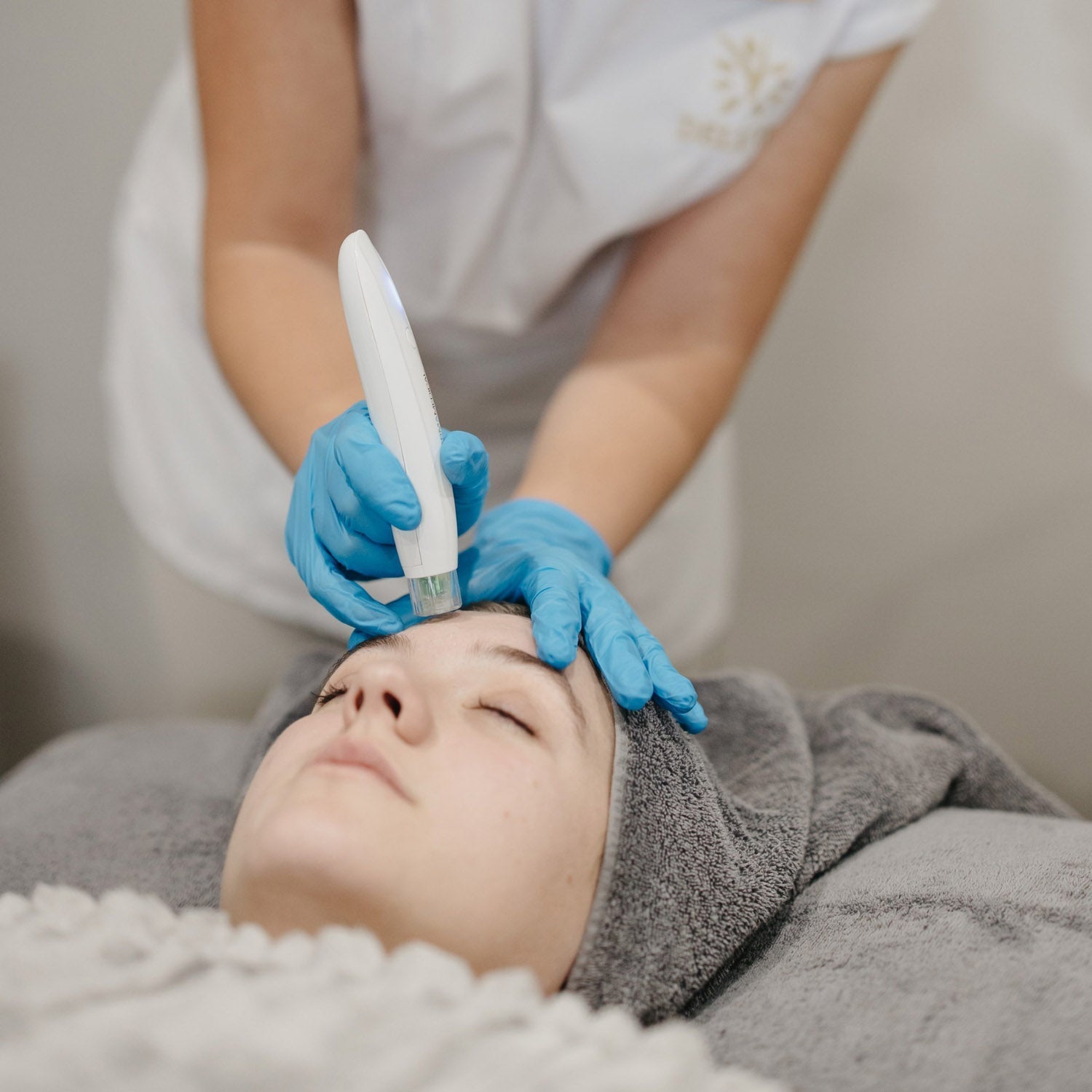 Microneedling in South Africa | The Complete Guide 2026