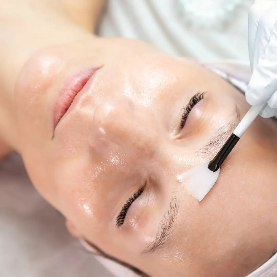Chemical Peel application 