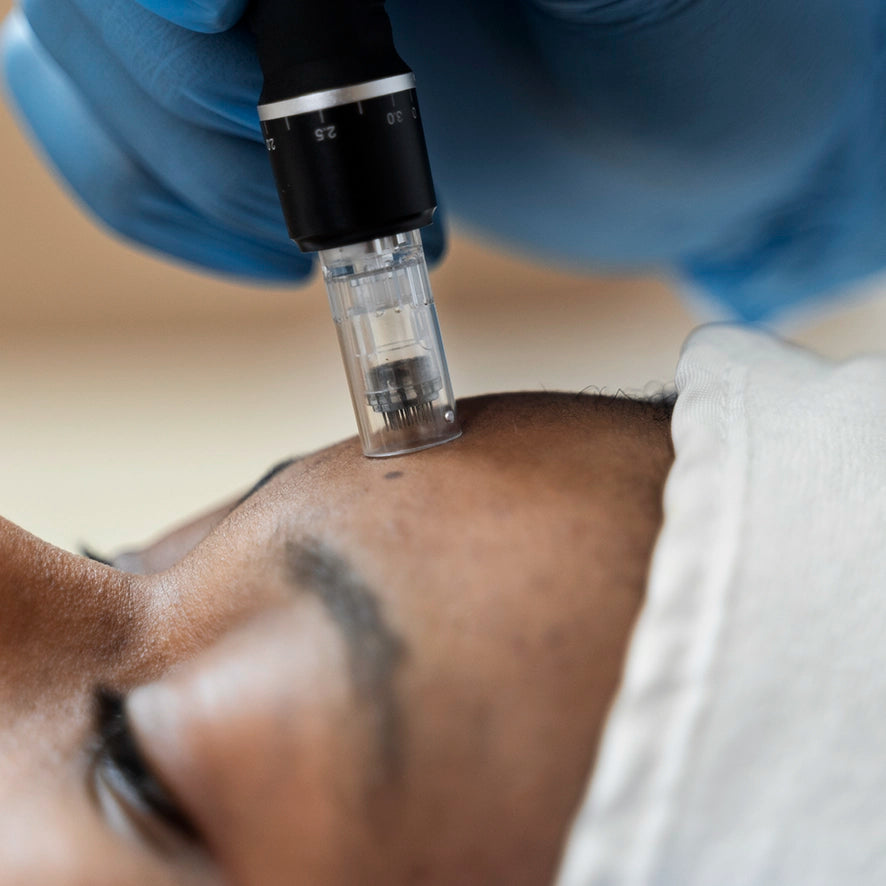 microneedling near me | dermapen treatments