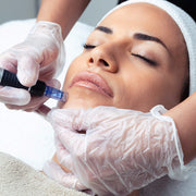 microneedling near me | dermapen treatments